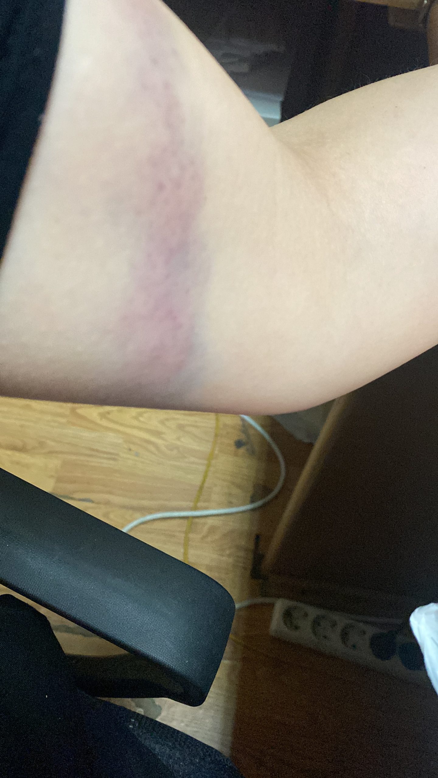 Da zaustavim pad prijateljice imala sam petlju slika