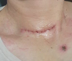 Moja najveća borba i avantura slika